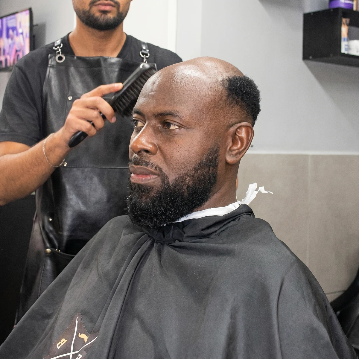Antes da prótese capilar masculina — entradas e linha frontal recuada